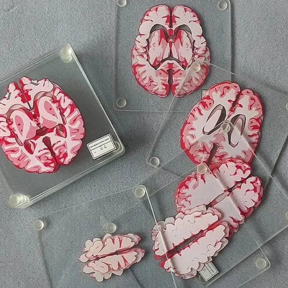 10 Brain specimen coasters - Picture 4 of 4